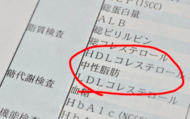 コレステロール