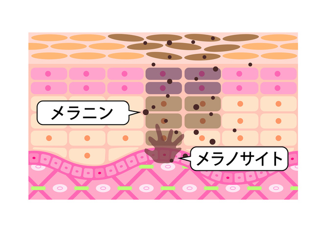 メラニンが産生