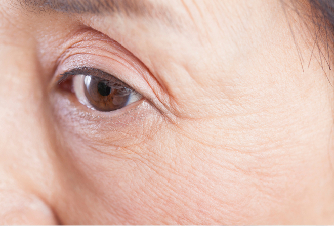 まぶたの形態は加齢とともに変化「まぶた画像」