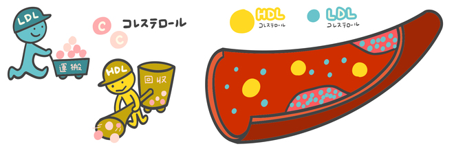 LDLコレステロール