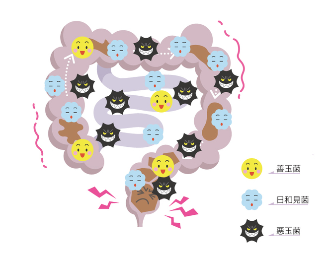 悪玉菌や日和見菌が優勢