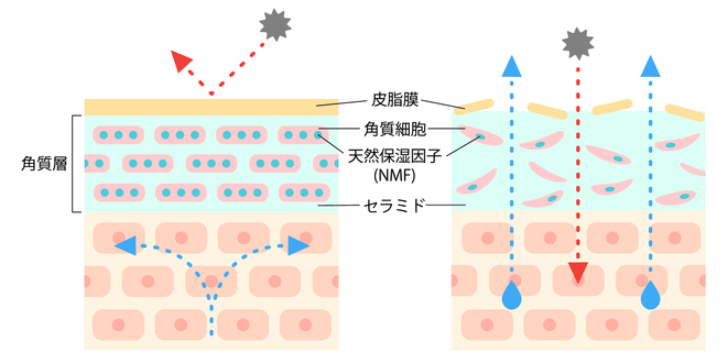 セラミドなどの保湿成分が減少