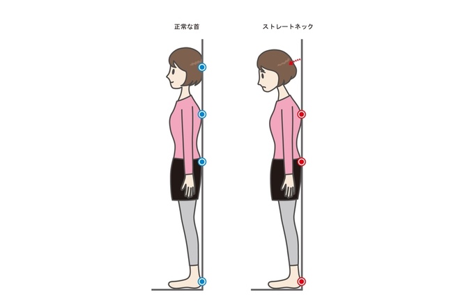 ストレートネックのセルフチェック方法