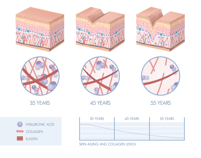 加齢によるコラーゲンの変化