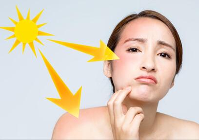 日焼けした後のケアはどうすべき？効果的なケア方法と注意点を解説