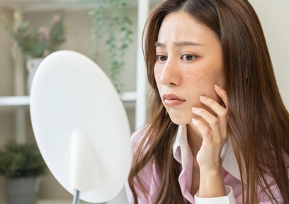 シミを作らせない！美白効果が期待できる天然由来成分とは？