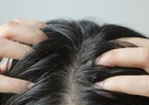 頭皮ケアに興味・関心がある女性を聞きました、髪の悩みと頭皮の悩みはどっちかが多い？